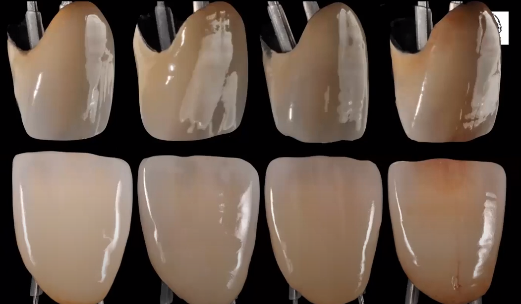 VIDEO: Ceramic layered on no precious alloy in the digital age