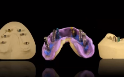 VIDEO: Dentistry Evolution or Dentistry Revolution