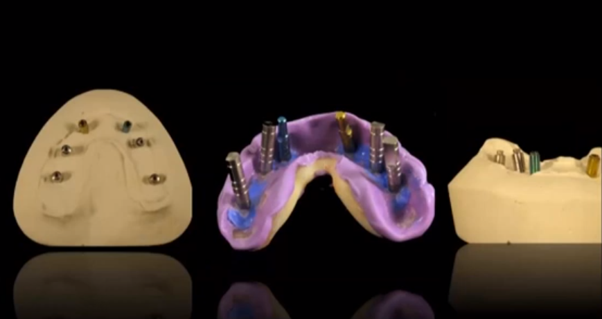 Dentistry Evolution or Dentistry Revolution